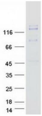 Coomassie blue staining of purified MET protein.